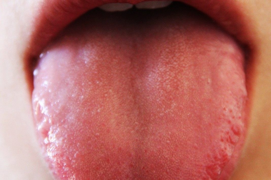 tongue-scraping
